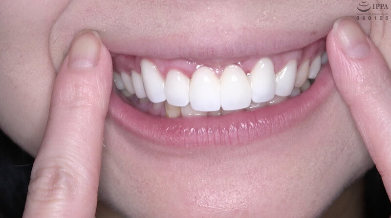 【2022年05月19日発売】歯舌ベロと電マオナニー 浜辺ことり